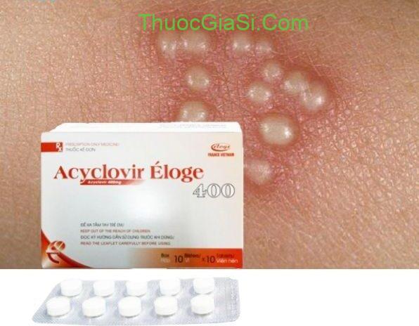 acyclovir-eloge-400-acyclovir-2752-3 Acyclovir Éloge 400|thuocgiasi.com