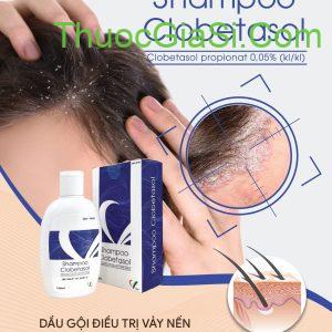 Shampoo Clobetasol VCP 100ml dầu gội cho người vảy nến da đầu
