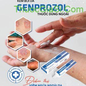 GENPROZOL điều trị nấm ngứa thường gặp, lang ben, hắc lào, nấm đồng tiền, ngứa dị ứng da